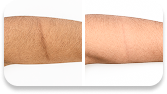 Antes y después LUXYA PRO - cuerpo